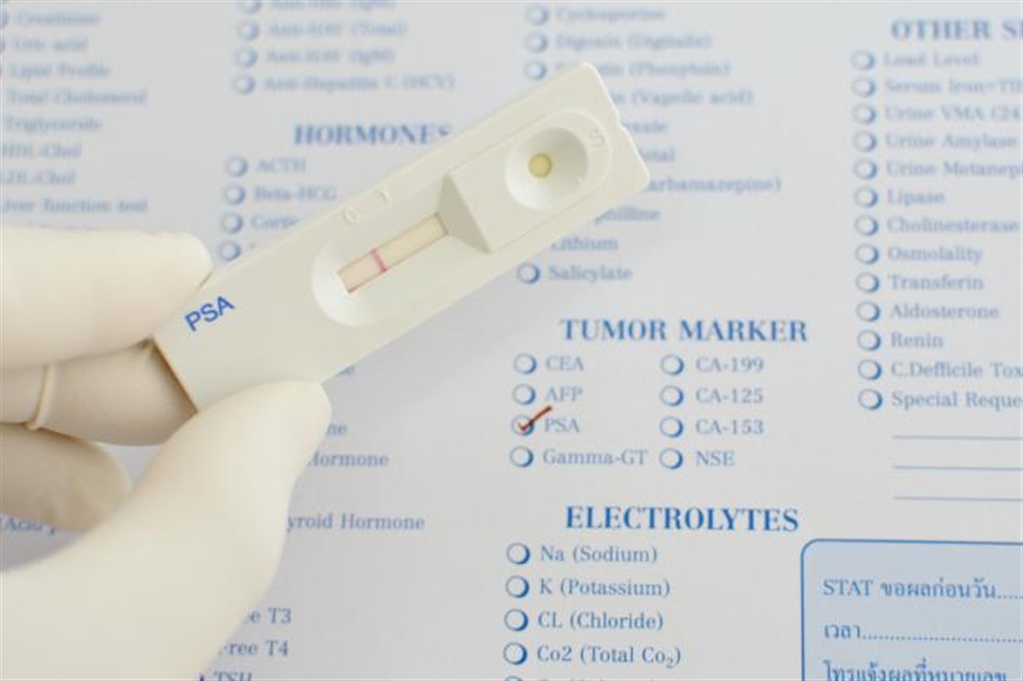  Routine prostate cancer screening